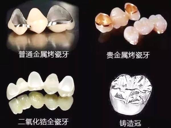 常德美奧口腔鉅惠看牙,韓國登騰種植牙3980元起,自鎖托槽矯正享5折優(yōu)惠！
