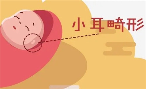 【河南中醫(yī)藥大學(xué)一附院】莊洪興教授暑假坐診，耳畸形修復(fù)限時(shí)預(yù)約！