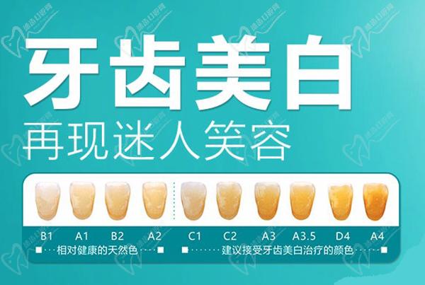 成都新橋口腔醫(yī)院牙齒美白活動