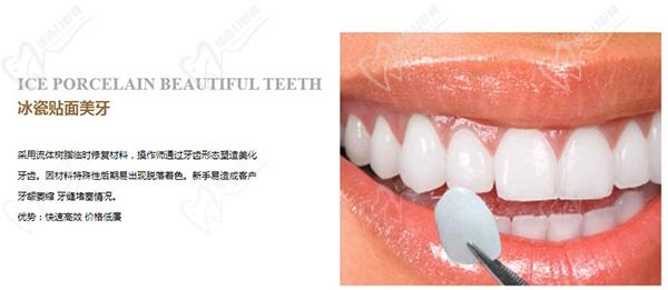 冰瓷牙和全瓷牙哪一個(gè)更好？看完冰瓷牙和全瓷牙的區(qū)別就明了