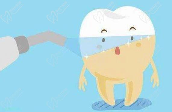 viva冷光美白是國(guó)產(chǎn)的嗎？