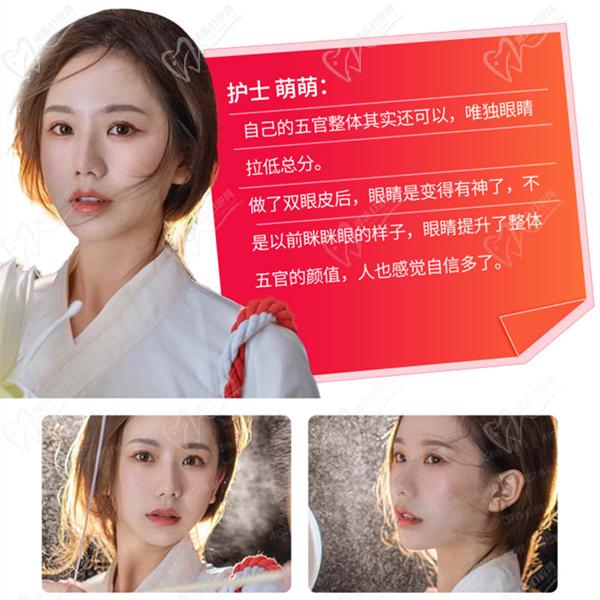 長沙愛思特雙眼皮手術(shù)圖