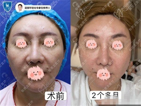 倪鋒拉皮真人圖片