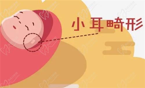 什么是耳畸形？哪些情況需要治療？