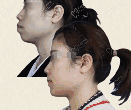 重慶肖林醫(yī)生技術怎么樣