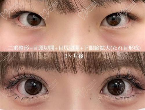 師麗麗的實(shí)例可信嗎?是不是營(yíng)銷出來(lái)的?