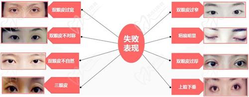 七、術(shù)前準(zhǔn)備與注意事項(xiàng)