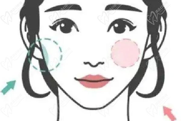 武漢藝星朱勝軍打除 皺針預約掛號