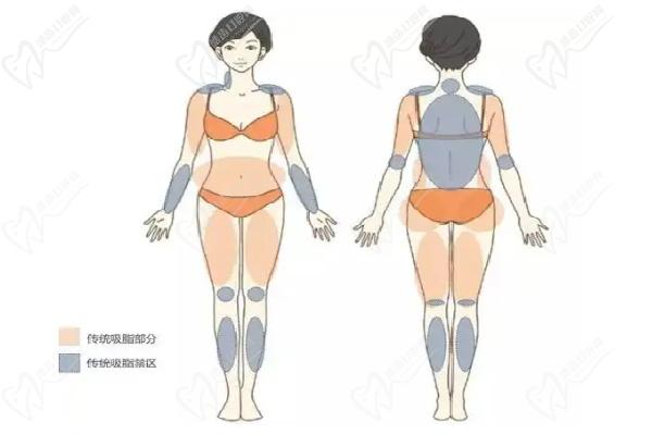 呂春龍吸脂價(jià)格費(fèi)用查詢