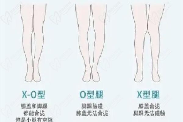 呂春龍吸脂詳情