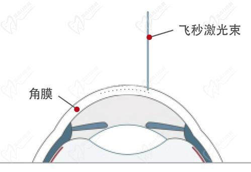 王曉瑛醫(yī)生在哪里出診？上海普瑞、上海和平等眼科醫(yī)院可預(yù)約