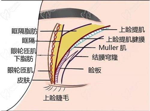 師麗麗雙眼皮修復成功率大嗎？看了好多真人修復實例和口碑評價無黑料